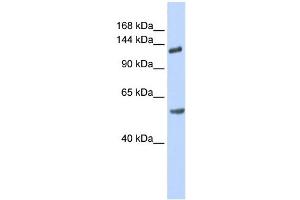 Image no. 1 for anti-Roundabout, Axon Guidance Receptor, Homolog 2 (ROBO2) (N-Term) antibody (ABIN2782202)