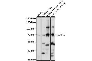 Image no. 1 for anti-Kelch-like protein 41 (KLHL41) antibody (ABIN6289966)