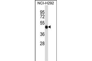 FCGR2A Antibody (C-term) (ABIN657646 and ABIN2846641) western blot analysis in NCI- cell line lysates (35 μg/lane).