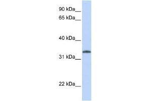 Image no. 1 for anti-Uridine-Cytidine Kinase 2 (UCK2) (N-Term) antibody (ABIN632007)