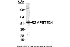 Image no. 1 for anti-Zinc Metalloproteinase, Ste24 (Zmpste24) (AA 1-100), (N-Term) antibody (ABIN363543)