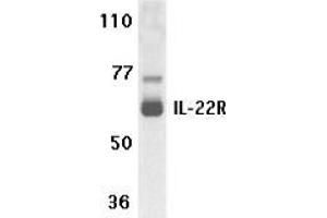Image no. 1 for anti-Interleukin 22 Receptor, alpha 1 (IL22RA1) (N-Term) antibody (ABIN499994)