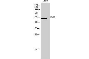 Image no. 1 for anti-serine/threonine Kinase 38 Like (STK38L) (C-Term) antibody (ABIN3185788)