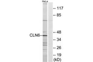 CLN6 antibody  (AA 221-270)