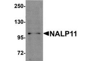 Image no. 1 for anti-NLR Family, Pyrin Domain Containing 11 (NLRP11) (C-Term) antibody (ABIN783717)
