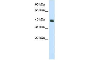 WB Suggested Anti-PUS1 Antibody Titration:  0.