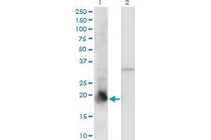 Image no. 3 for anti-Peptidylprolyl Isomerase (Cyclophilin)-Like 1 (PPIL1) (AA 76-166) antibody (ABIN565647)