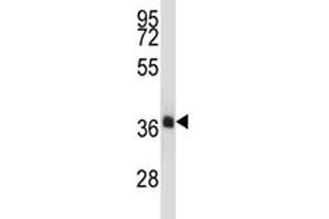 Image no. 2 for anti-NK2 Homeobox 4 (NKX2-4) (AA 2-4) antibody (ABIN3028871)