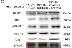 Image no. 43 for anti-Actin, beta (ACTB) (AA 1-50) antibody (ABIN724340)