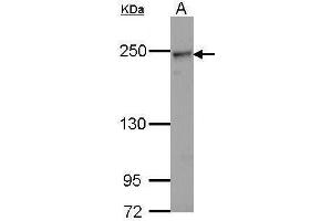Image no. 1 for anti-Collagen, Type IV, alpha 2 (COL4A2) (Center) antibody (ABIN2854393)