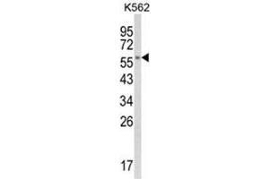Image no. 1 for anti-Cytochrome P450, Family 8, Subfamily B, Polypeptide 1 (CYP8B1) (C-Term) antibody (ABIN453612)