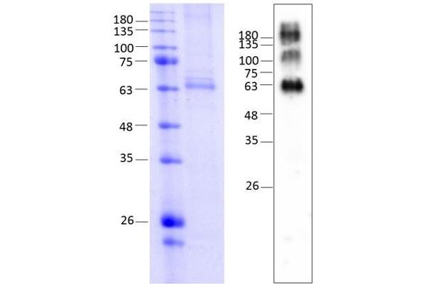 MC4R Protein (AA 1-332) (rho-1D4 tag)