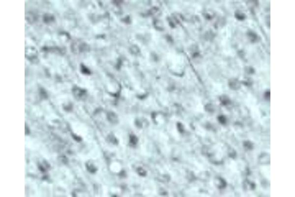anti-N-Ethylmaleimide-Sensitive Factor (NSF) (N-Term) antibody