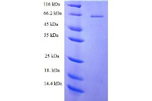 PLCz1 Protein (AA 1-415, partial) (His-SUMO Tag)