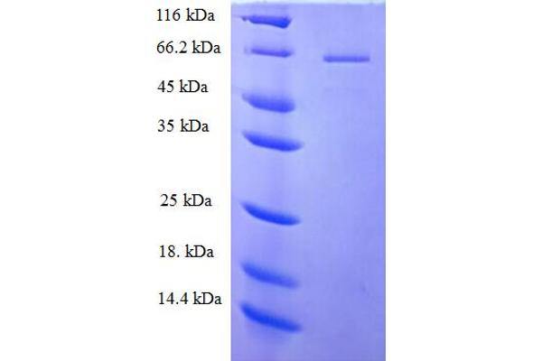 PLCz1 Protein (AA 1-415, partial) (His-SUMO Tag)