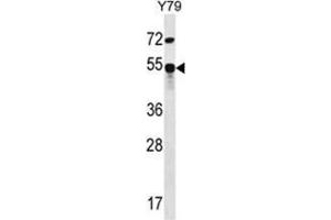 Image no. 1 for anti-Zinc Finger Protein 14 Homolog (ZFP14) (AA 71-100), (N-Term) antibody (ABIN955658)
