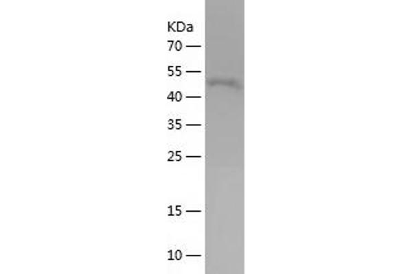 RHOB Protein (AA 1-196) (IF2DI tag)