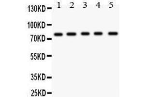 KIF2C Antikörper  (AA 531-725)