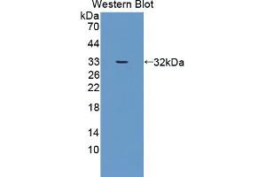 Image no. 1 for anti-Dickkopf-Like 1 (DKKL1) (AA 21-230) antibody (ABIN5013454)