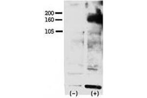 Image no. 2 for anti-V-Erb-A erythroblastic Leukemia Viral Oncogene Homolog 4 (Avian) (ERBB4) (pTyr1162) antibody (ABIN3029487)