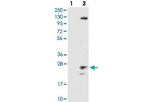 Image no. 1 for anti-Transmembrane Protein 186 (TMEM186) antibody (ABIN5589663)