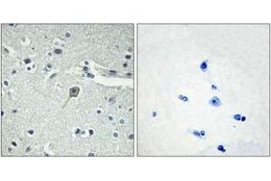 Image no. 1 for anti-Parathyroid Hormone 1 Receptor (PTH1R) (AA 145-194) antibody (ABIN1535655)