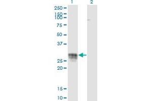 Image no. 3 for anti-CD83 (CD83) (AA 1-205) antibody (ABIN564015)