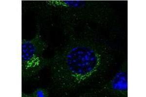 Image no. 1 for anti-RAB3A, Member RAS Oncogene Family (RAB3A) (C-Term) antibody (ABIN1440023)