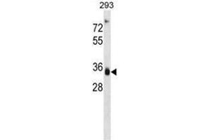 Image no. 1 for anti-Aldo-Keto Reductase Family 1, Member D1 (AKR1D1) (AA 110-139), (Middle Region) antibody (ABIN950324)