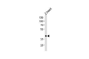 Image no. 1 for anti-Homeobox D11 (HOXD11) (AA 128-155) antibody (ABIN1881434)