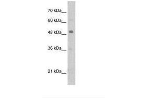 PBX3 anticorps  (N-Term)