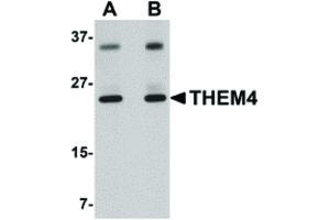 Image no. 1 for anti-Thioesterase Superfamily Member 4 (THEM4) (Internal Region) antibody (ABIN6656405)