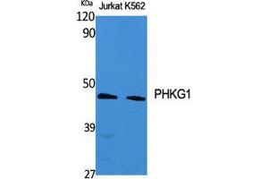 Image no. 2 for anti-phosphorylase Kinase, gamma 1 (Muscle) (PHKG1) (Internal Region) antibody (ABIN3186424)