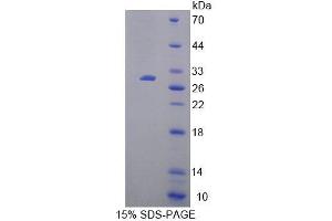 Image no. 1 for High Mobility Group 20B (HMG20B) (AA 27-213) protein (His tag) (ABIN6239326)