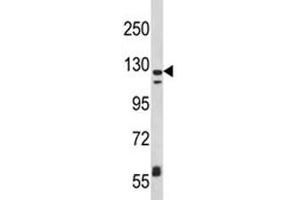 Image no. 5 for anti-Integrin, alpha X (Complement Component 3 Receptor 4 Subunit) (ITGAX) (AA 1119-1145) antibody (ABIN3031404)