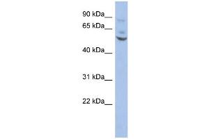 Image no. 1 for anti-Ets Variant 1 (ETV1) (Middle Region) antibody (ABIN2780627)