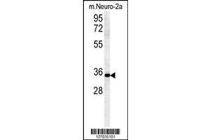 Image no. 1 for anti-Zinc Finger, DHHC-Type Containing 2 (ZDHHC2) (AA 77-106) antibody (ABIN651781)