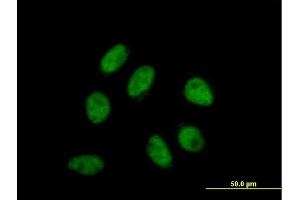 Image no. 1 for anti-Anaphase Promoting Complex Subunit 4 (ANAPC4) (AA 1-808) antibody (ABIN526176)