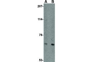 Image no. 2 for anti-Apoptosis-Inducing Factor, Mitochondrion-Associated, 3 (AIFM3) (N-Term) antibody (ABIN6656624)
