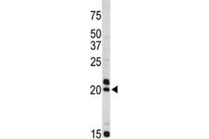 Image no. 1 for anti-Vasoactive Intestinal Peptide (Vip) (AA 139-167) antibody (ABIN3029584)