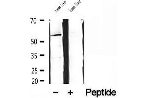 Image no. 3 for anti-Src Kinase Associated Phosphoprotein 2 (SKAP2) (C-Term) antibody (ABIN6265100)