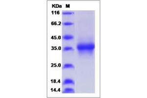 Image no. 1 for Stanniocalcin 1 (STC1) (AA 1-247) protein (His tag) (ABIN2006504)