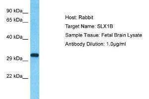 Image no. 1 for anti-SLX1 Structure-Specific Endonuclease Subunit Homolog B (SLX1B) (N-Term) antibody (ABIN2791914)