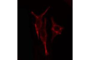 Image no. 2 for anti-Apolipoprotein L, 2 (APOL2) antibody (ABIN6256906)