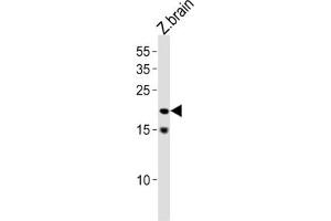 Image no. 1 for anti-Transcription Factor 21 (TCF21) antibody (ABIN3004721)