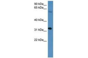 Image no. 1 for anti-Homeobox D13 (HOXD13) (AA 174-223) antibody (ABIN6746038)