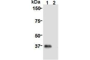Image no. 1 for anti-Cell Division Cycle Associated 8 (CDCA8) (AA 1-280), (N-Term) antibody (ABIN1449290)
