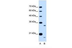 Image no. 1 for anti-Cell Cycle Progression 1 (CCPG1) (AA 301-350) antibody (ABIN6738251)
