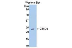 Image no. 1 for anti-Cartilage Oligomeric Matrix Protein (COMP) (AA 235-423) antibody (ABIN1858467)
