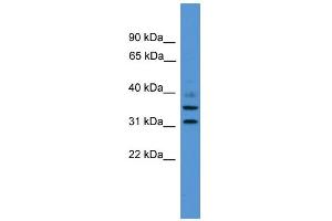 Image no. 1 for anti-GTPase, IMAP Family Member 6 (GIMAP6) (C-Term) antibody (ABIN2786559)